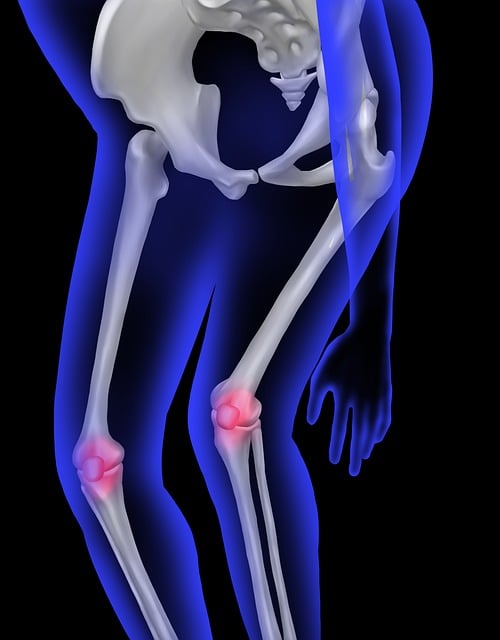 knee in health-medical