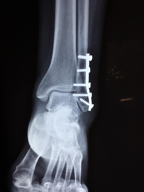 ankle in health-medical-3