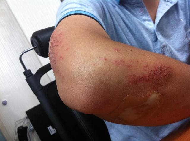 scrape in health-medical-4