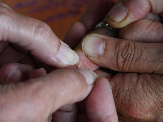 wound in health-medical-3